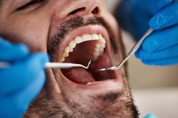 Best Broken or Chipped Tooth Repair in North Pekin, IL